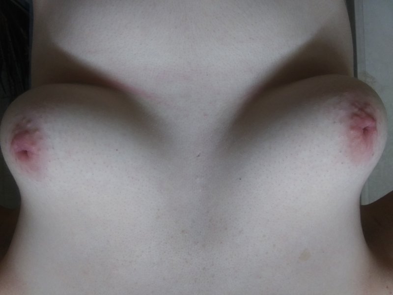 Женская грудь