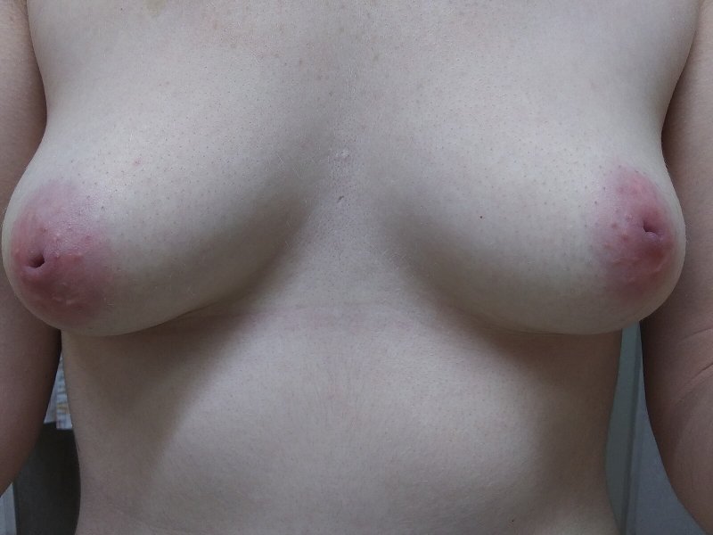 Женская груди