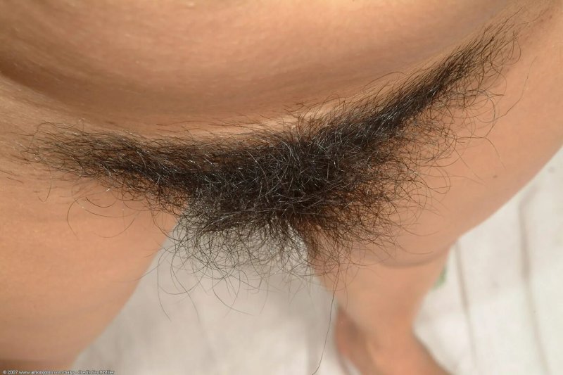 Самые длинные лобковые волосы