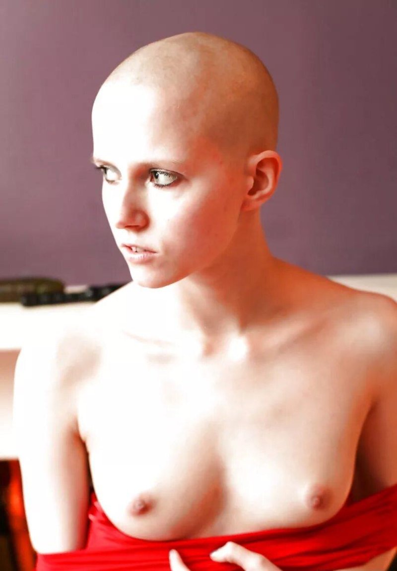 Лысая прическа