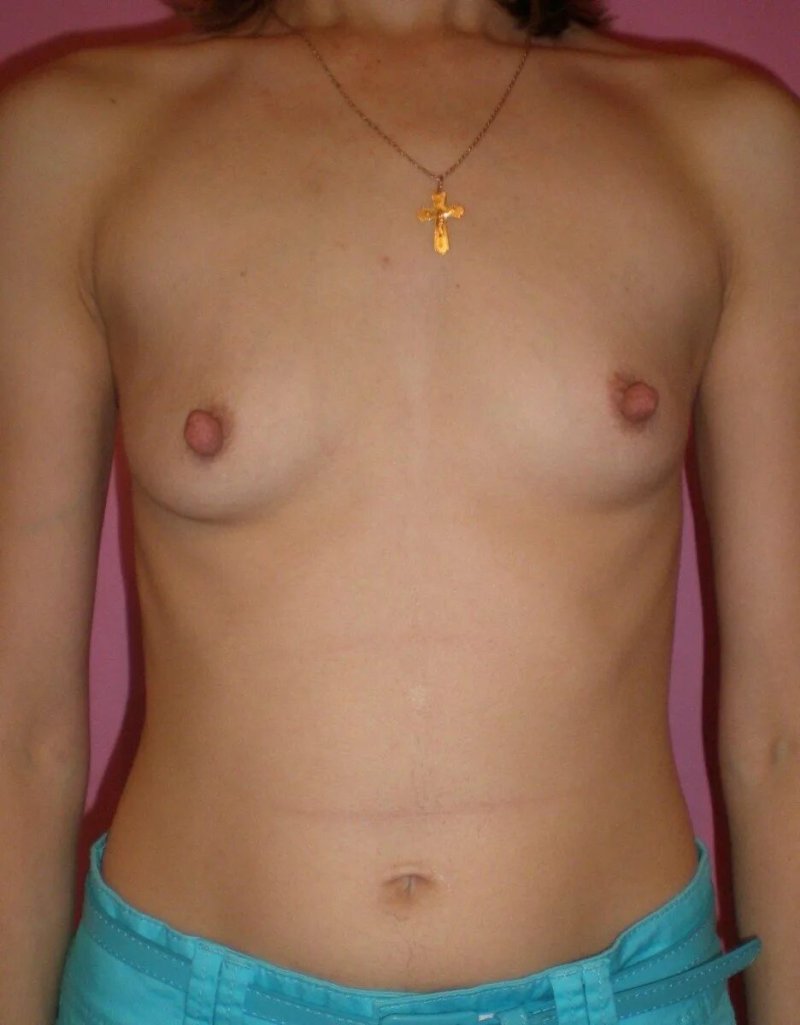 Голые сиськи первого размера