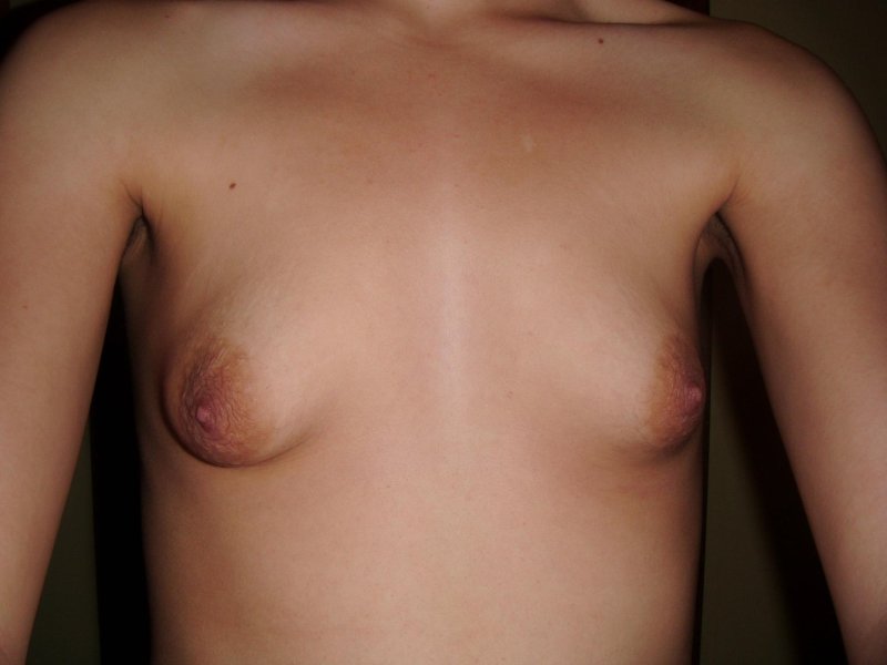 Маленькие некрасивые сиськи