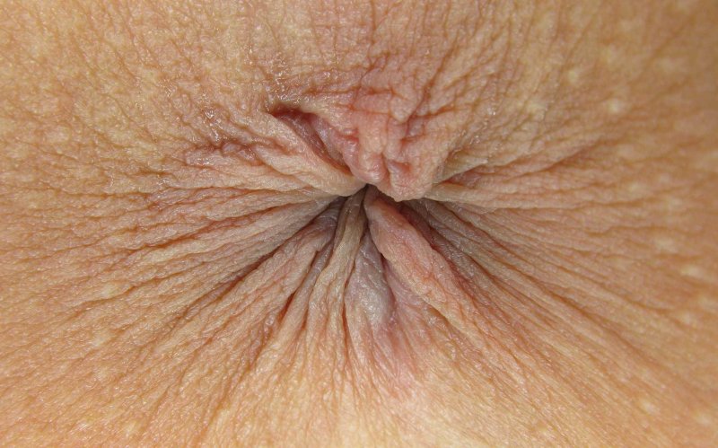 Необычный женский анус