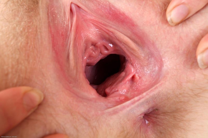 Раскрытая вагина крупным планом