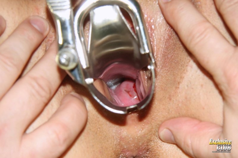 Вагина гинекологическое зеркало