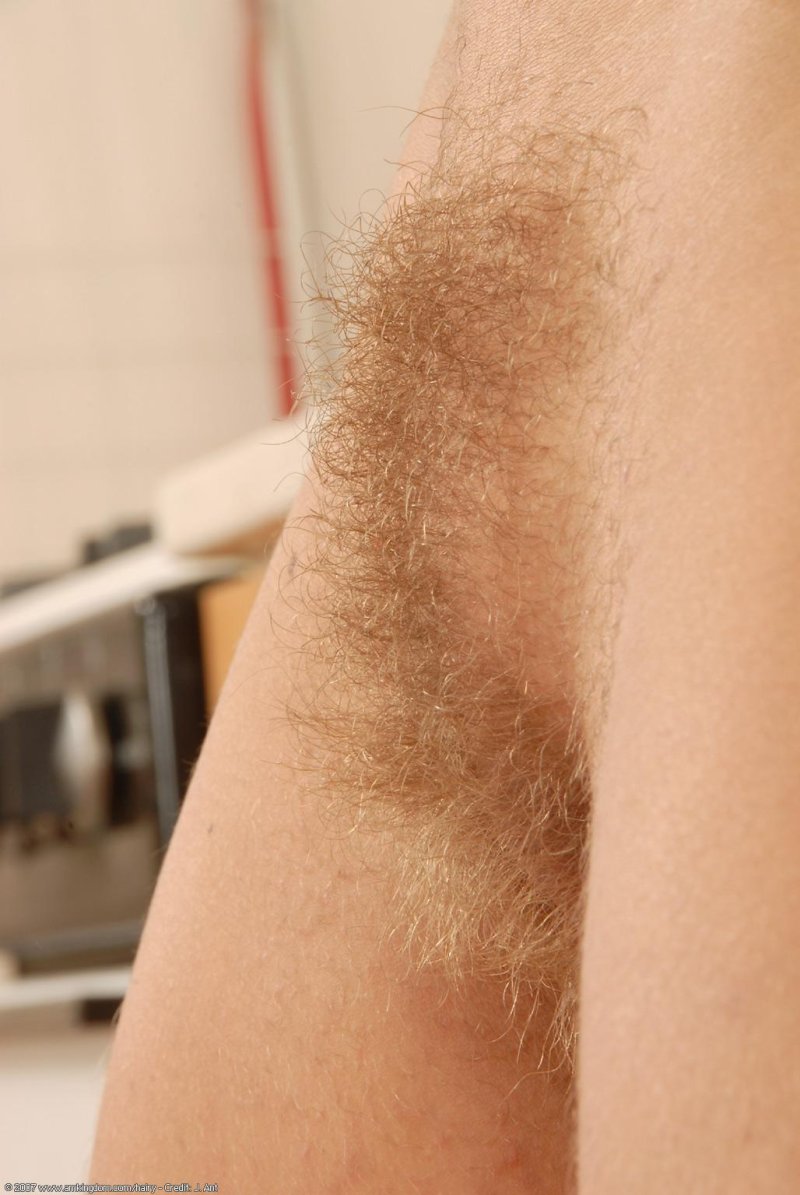 Белое пятно на коже