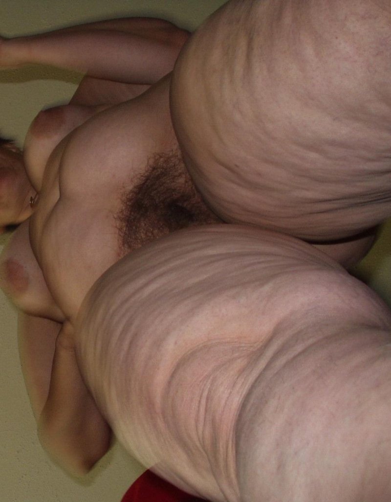 Волосатая старуха целлюлит