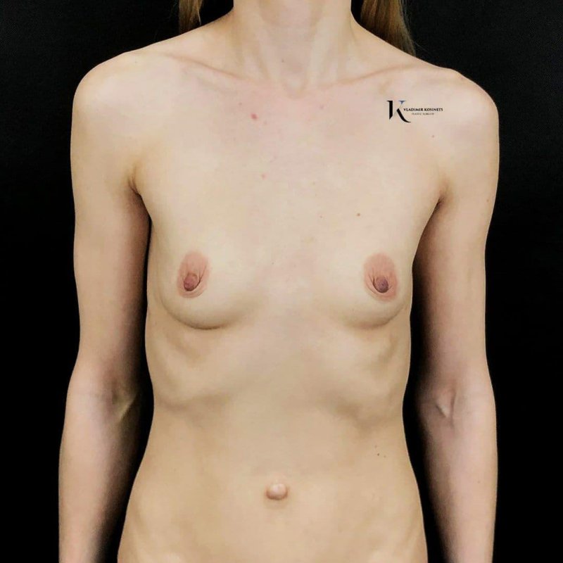 Девушки с нулевым размером груди