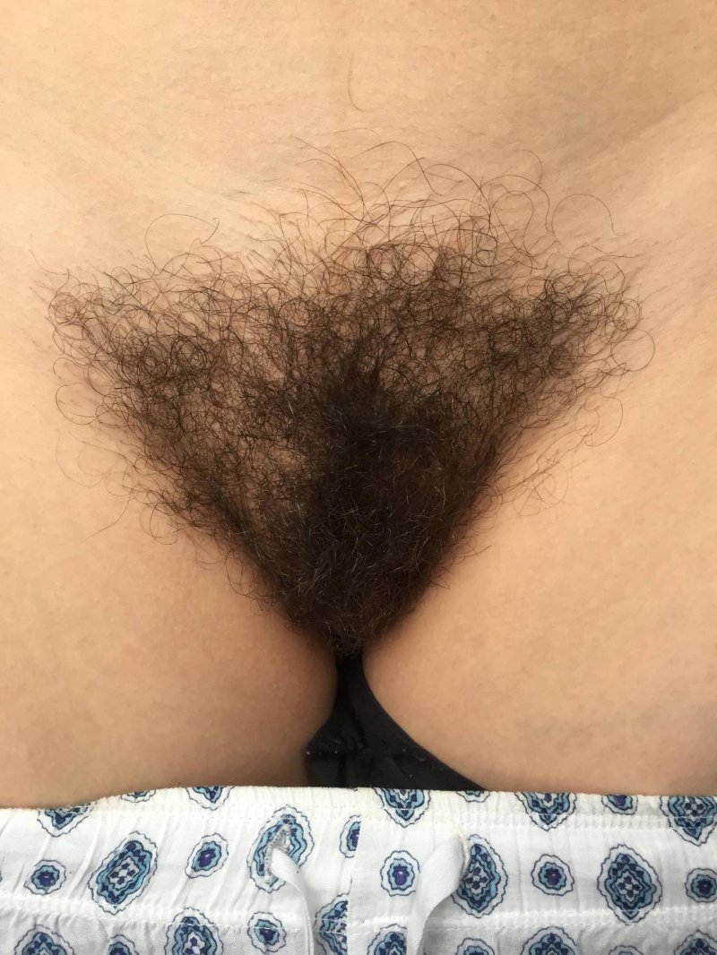 Лобковые волосы