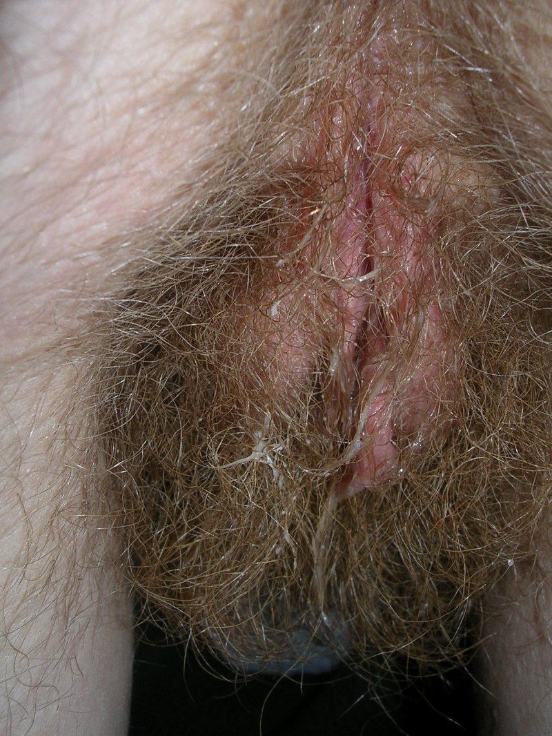 Волосатая вульва девочки