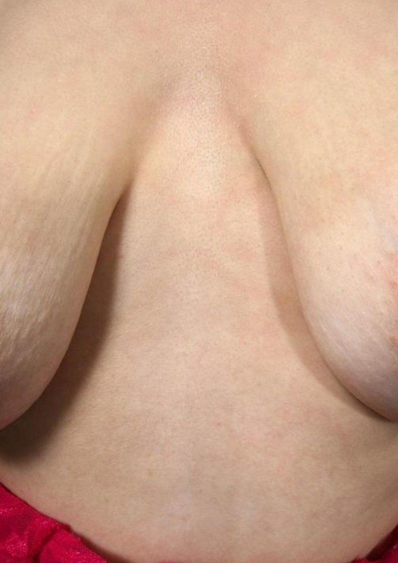 Большая обвисшая грудь