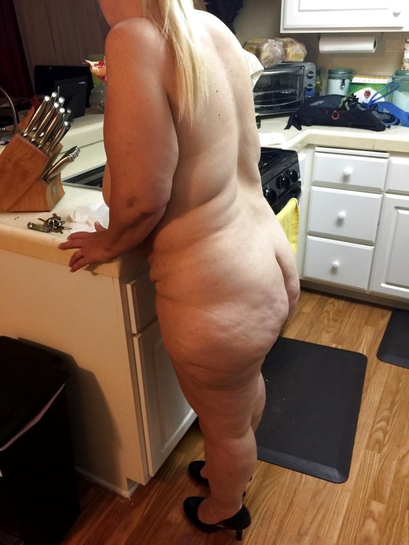 Целлюлитные ягодицы