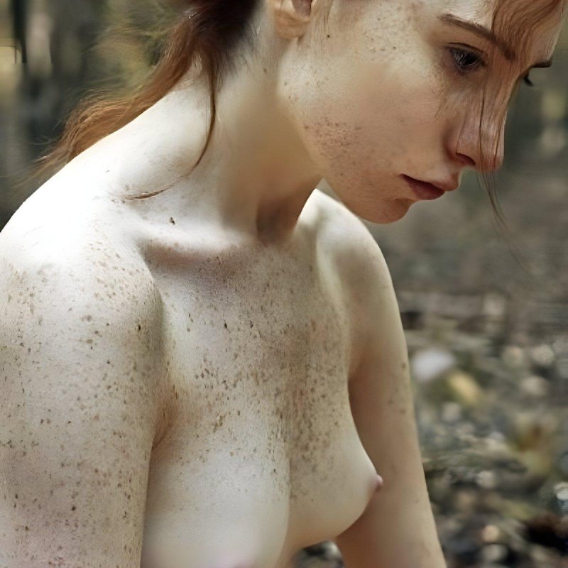 Веснушки ню