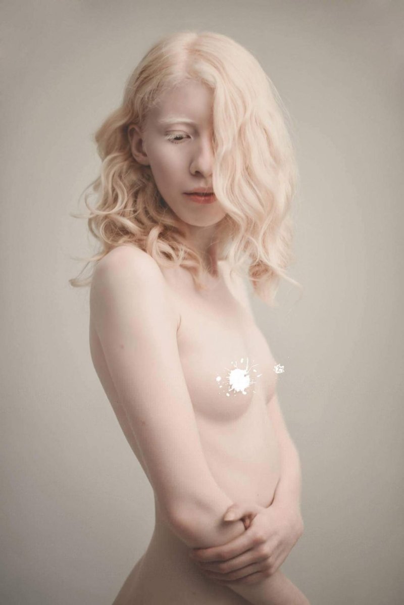 Амелия ньюсхэм альбинос