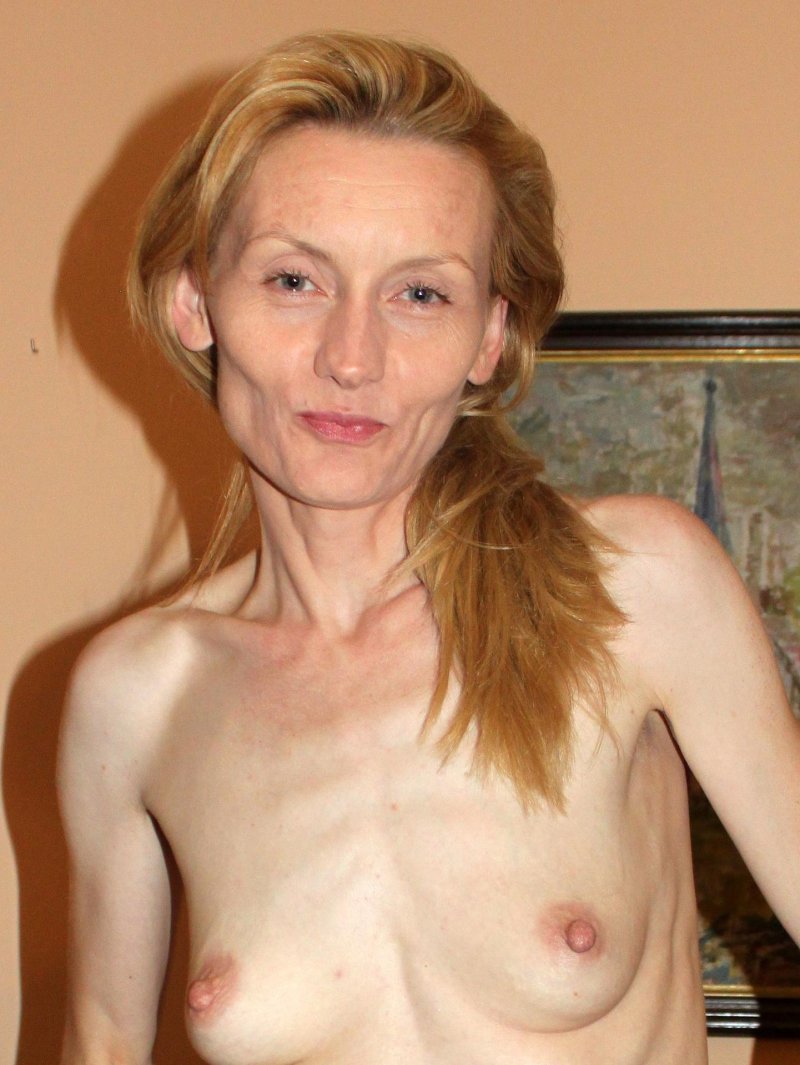 Изабель каро анорексия