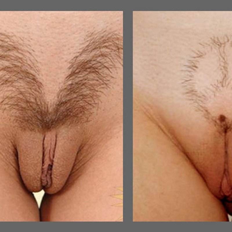 Женские прически на лобке