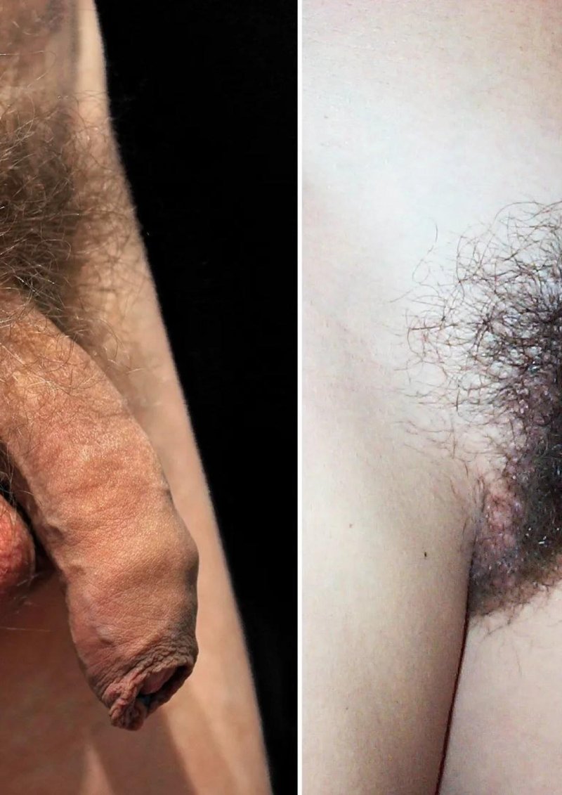 Лобковые волосы у мужчин