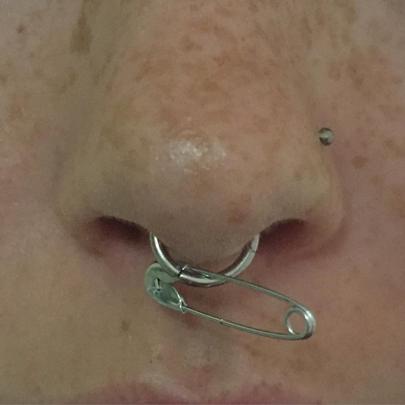 Септум прокол