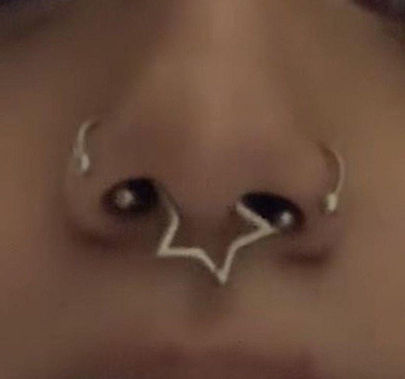 Септум циркуляр