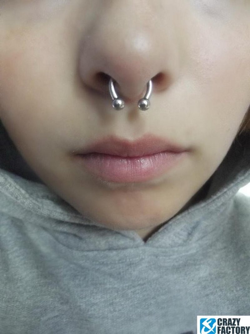 Септум подкова