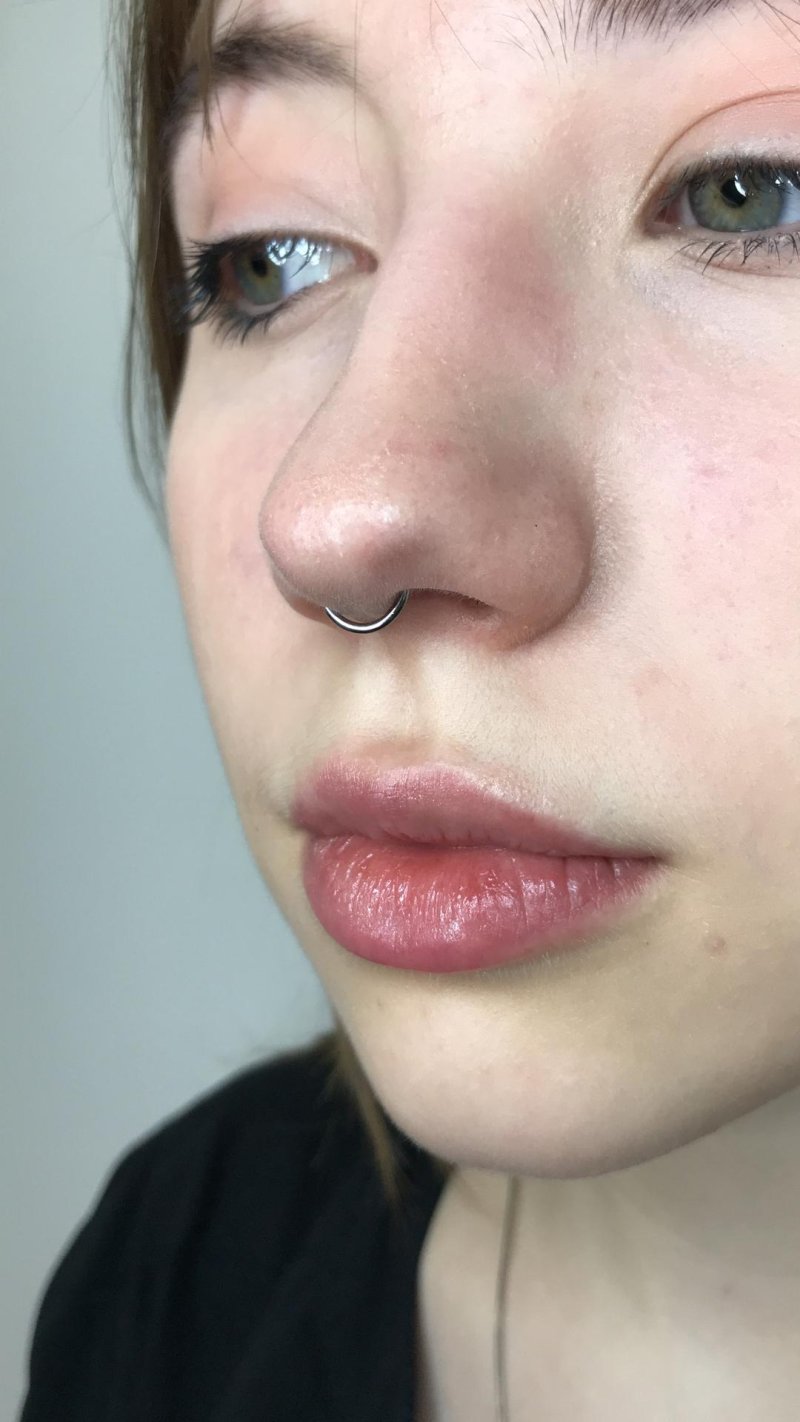 Прокол крыла носа