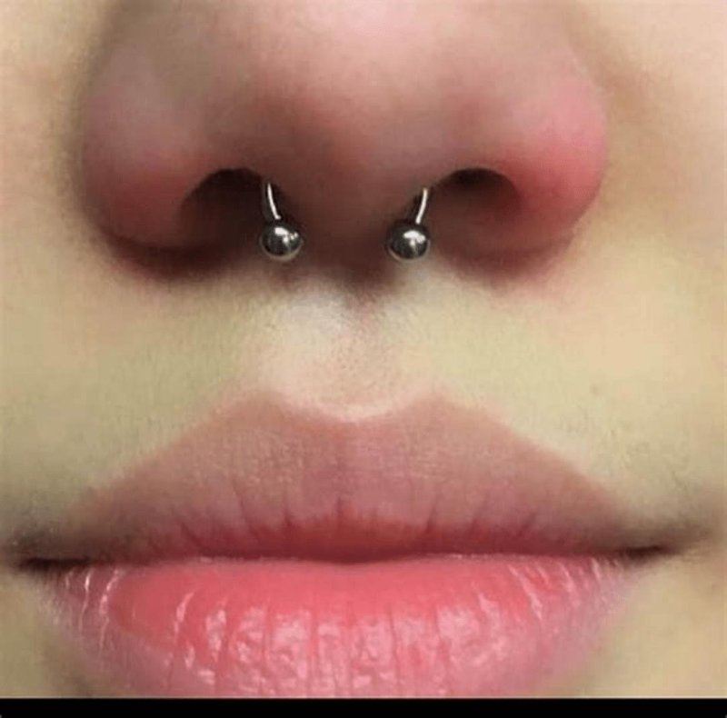 Септум в нос