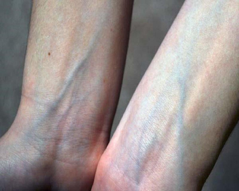 Вены на запястье