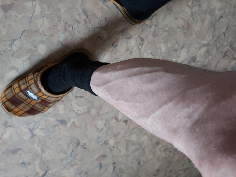 На ногах видны вены