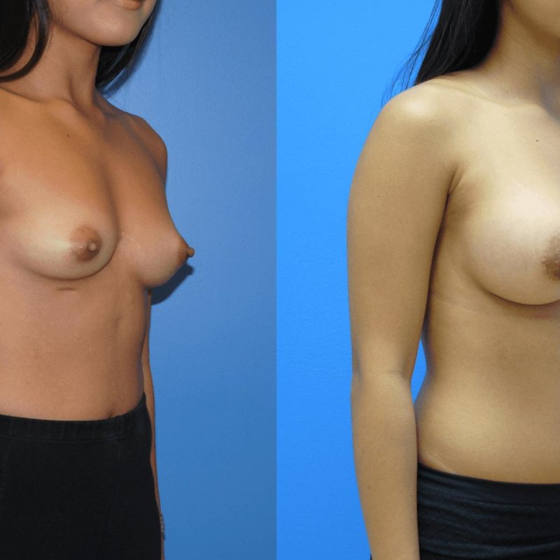 Сиськи первого размера