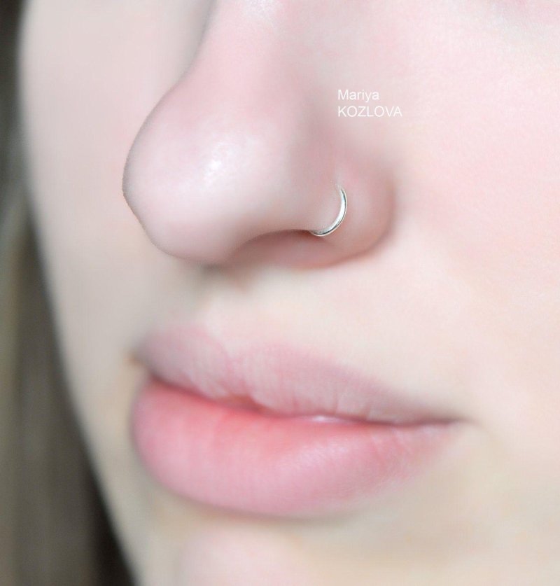 Келоид септум