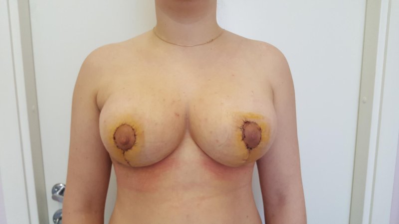 Женская грудь большие соски