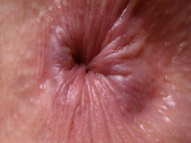 Анус крупно