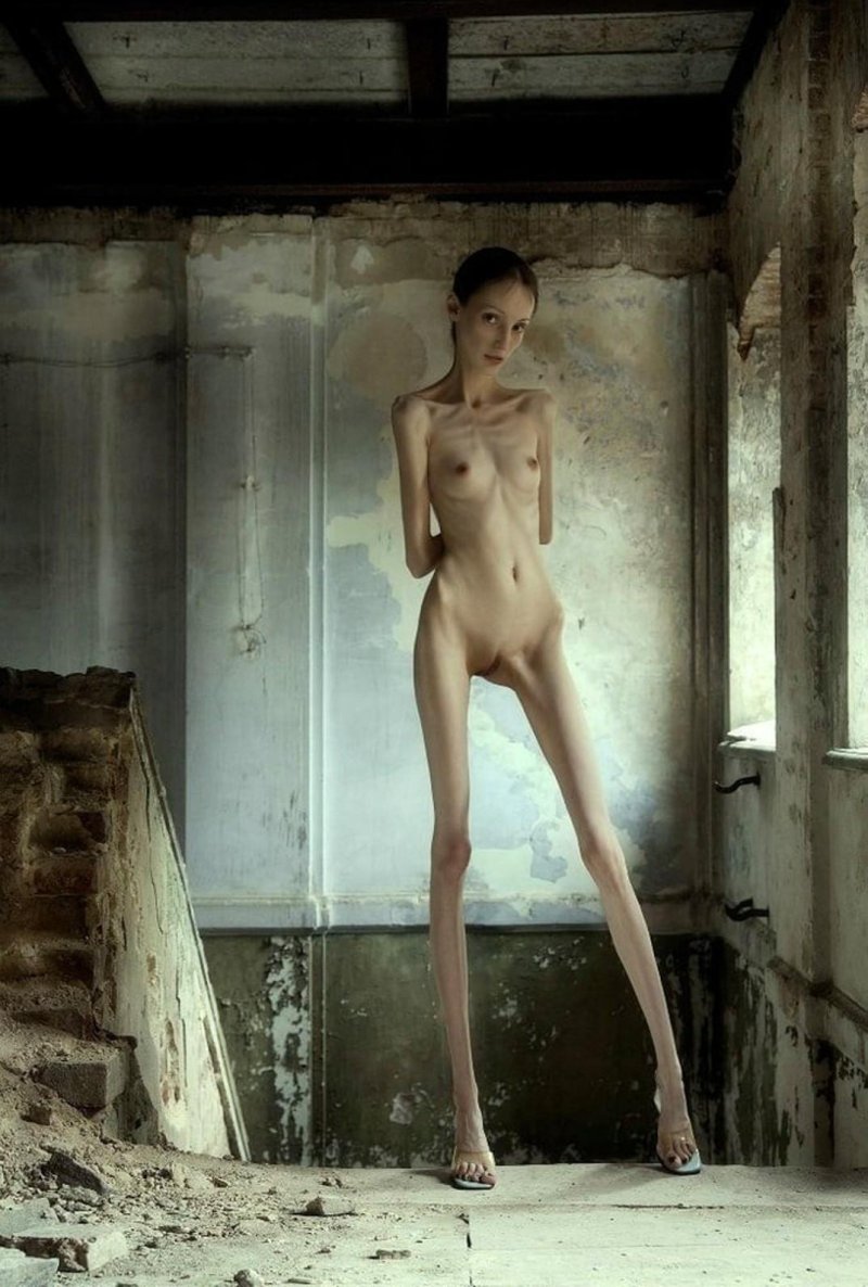 Голые анорексичные женщины