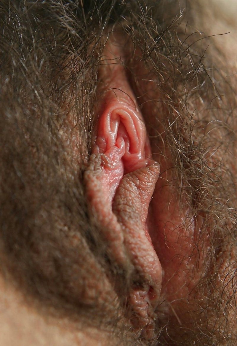 Язвы на влагалище