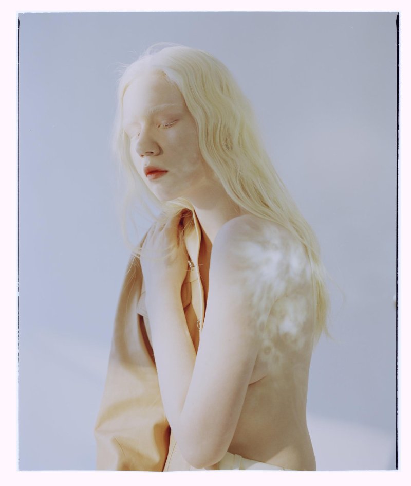 Модели альбиносы