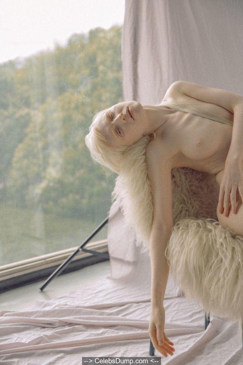 Анастасия жидкова альбинос