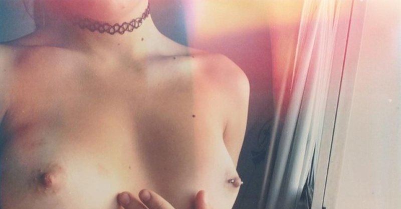 Микродермал в яремной впадине