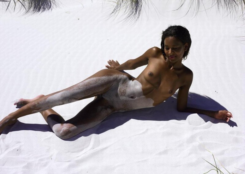 Витилиго винни харлоу