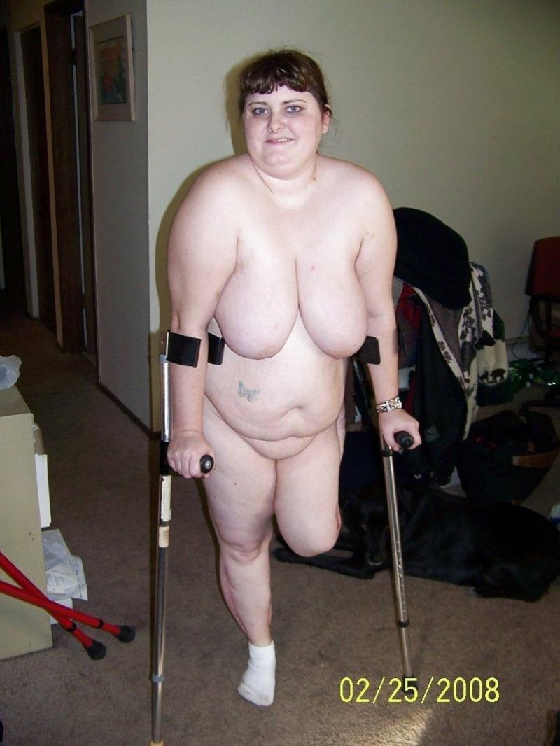 Голые пухлые женщины инвалиды
