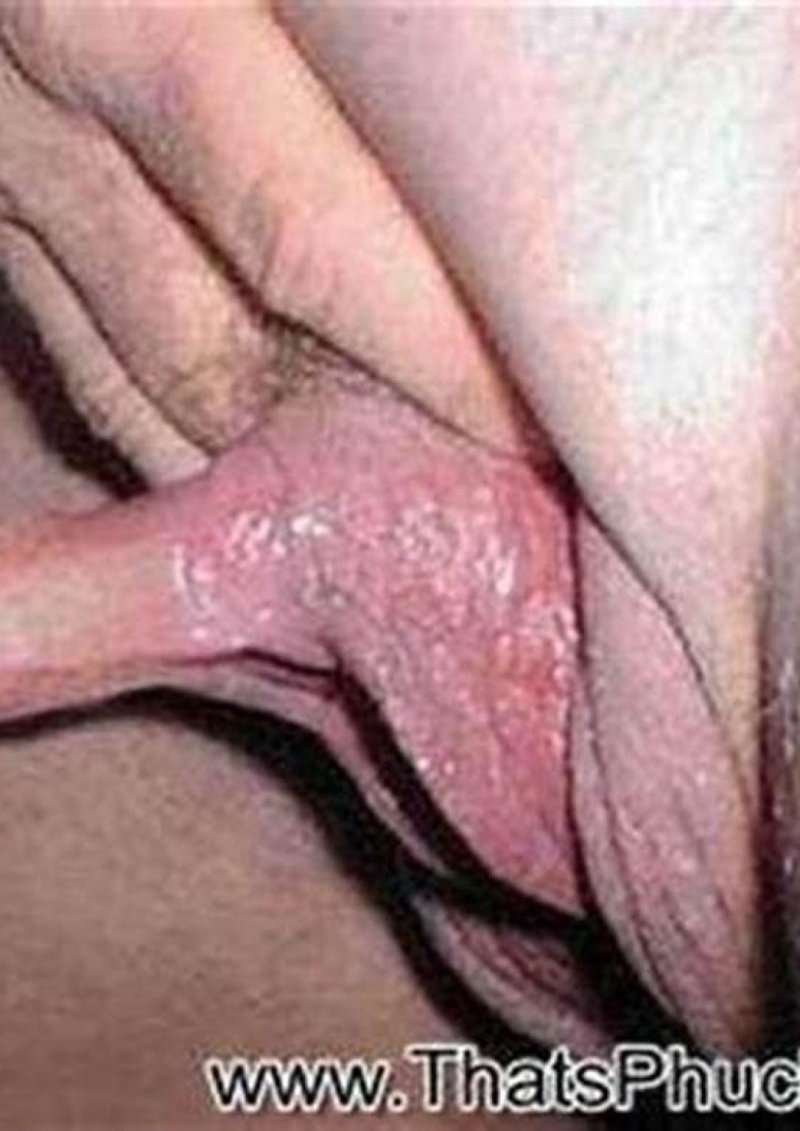 Самый большой клиторок