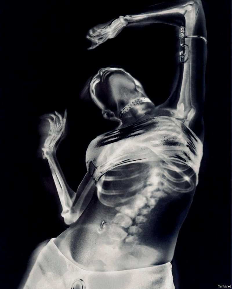 Рентген девушки