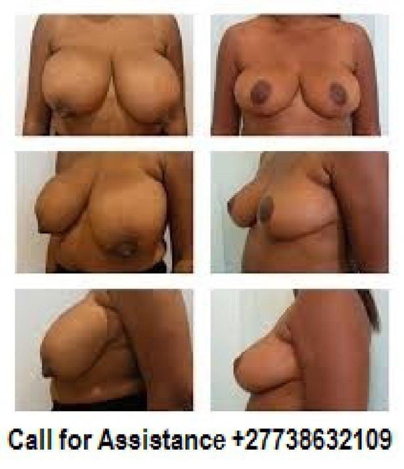 Голые сиськи разного размера