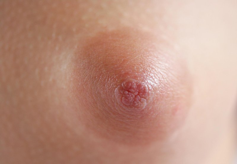 Ареола груди