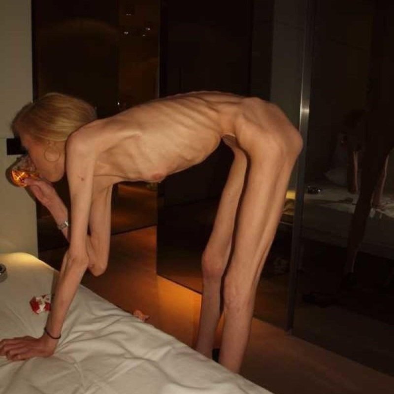 Очень худая женщина