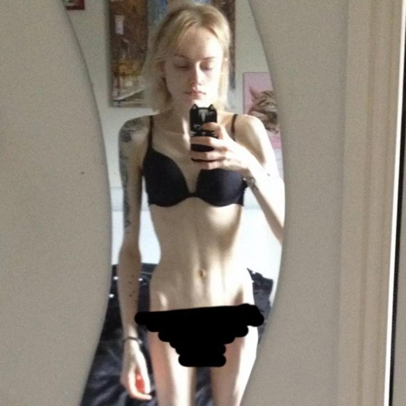 Красивая анорексия