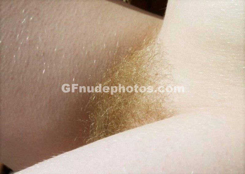 Белые волосы на лобке