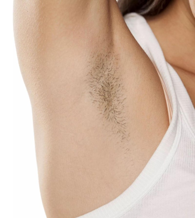 Волосы на подмышках у женщин