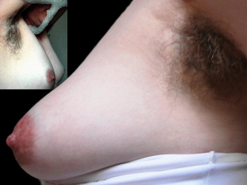 Волосы на подмышках