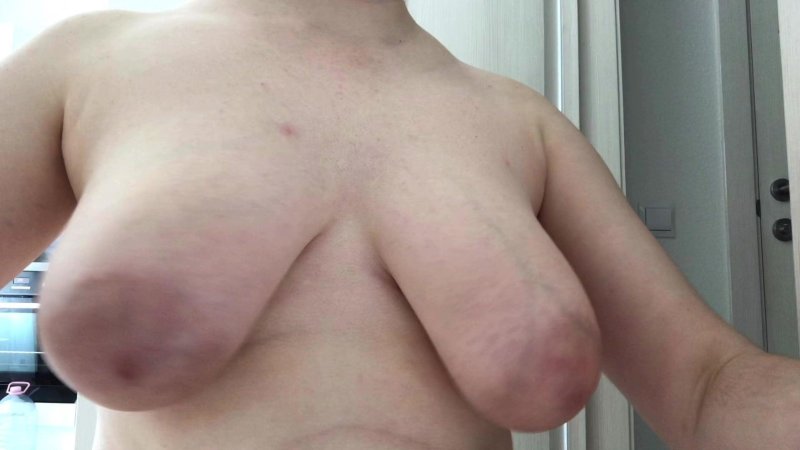 Женщины с удаленной грудью