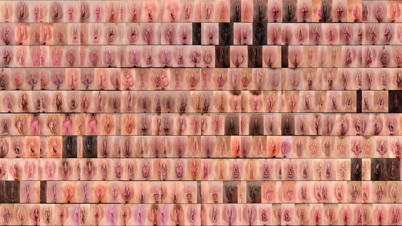 Самый распространенный вид вагины